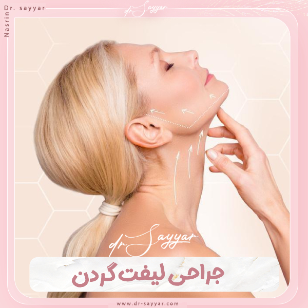 جراحی لیفت گردن - دکتر نسرین سیار