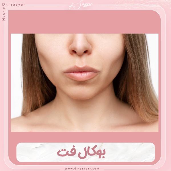 بوکال فت