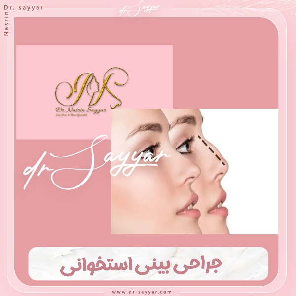 جراحی بینی استخوانی