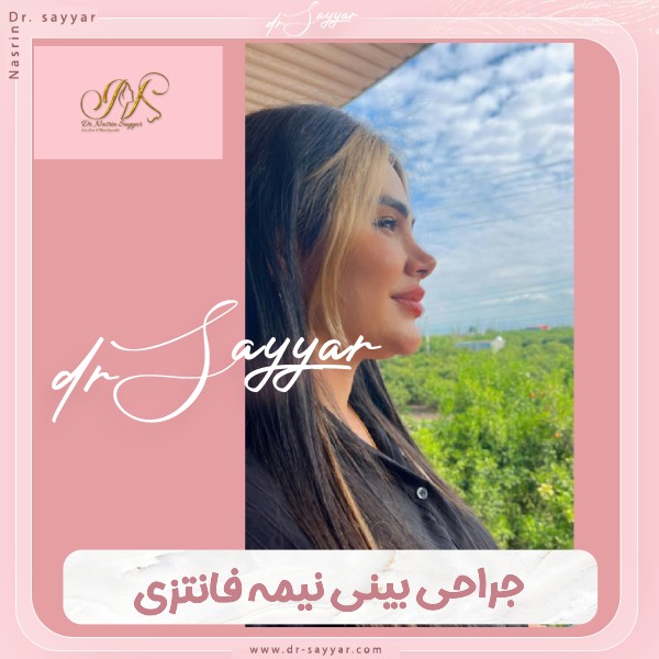 جراحی بینی نیمه فانتزی