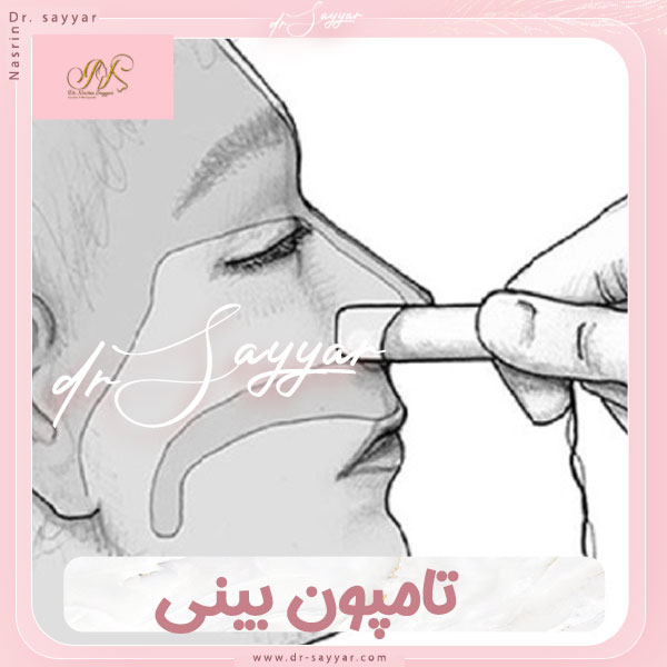 تامپون بینی