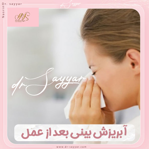 آبریزش بینی بعد از عمل
