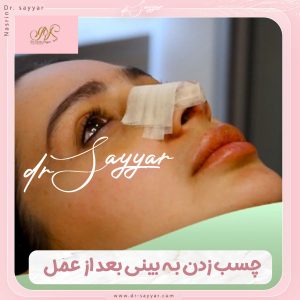 توصیه ها ی چسب زدن بینی بعد از عمل با دکتر سیار در استان مازندران