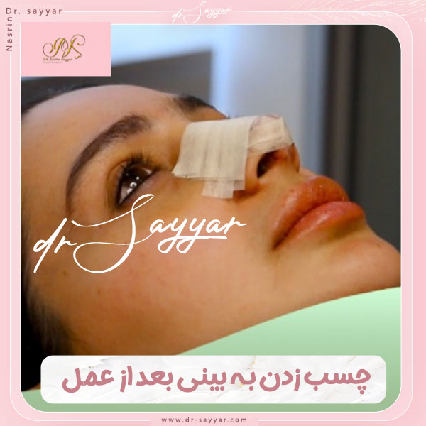 توصیه ها ی چسب زدن بینی بعد از عمل با دکتر سیار در استان مازندران